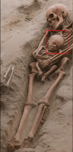 Skeletal Remains